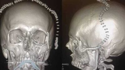 D272220E1C68CA2C584EA98D4DA9DB10