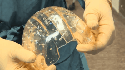 Plastic skull Utrecht