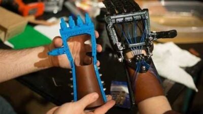 talon hand 20 prosthetiko xeri