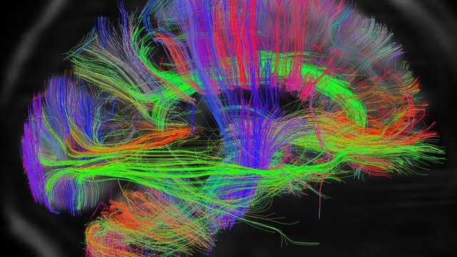 brain