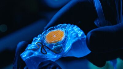augmental mouthpad